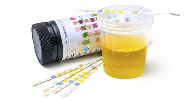 5 complications of urinary tract infection you should know - Read