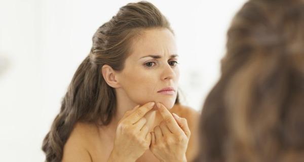 castor oil for acne