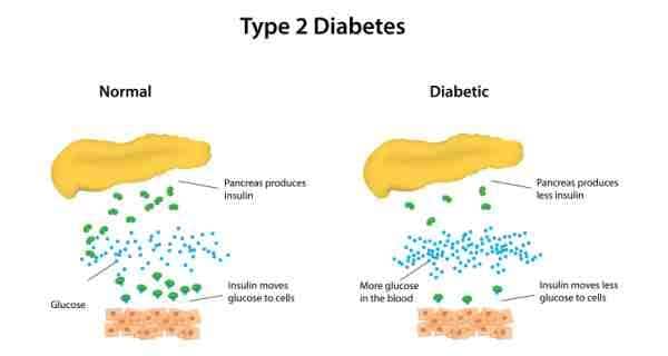 How are the symptoms of Type 2 diabetes treated?