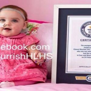 1 minute after her birth, Chanel becomes the youngest patient to undergo an open heart surgery 1 minute after her birth, Chanel becomes the youngest patient to undergo an open heart surgery