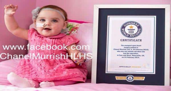 1 minute after her birth, Chanel becomes the youngest patient to undergo an open heart surgery 1 minute after her birth, Chanel becomes the youngest patient to undergo an open heart surgery