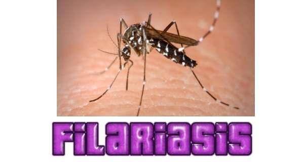 Filariasis