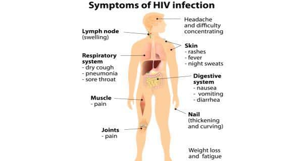 What are the signs and symptoms of HIV?