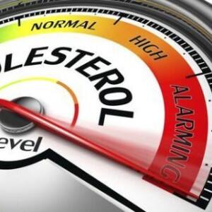 Good cholesterol not good after all, study says excess HDL may shorten your life Good cholesterol not good after all, study says excess HDL may shorten your life