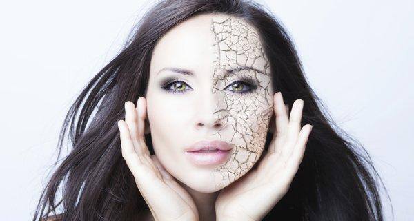 dry skin