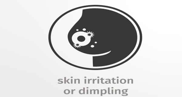 skin irritation