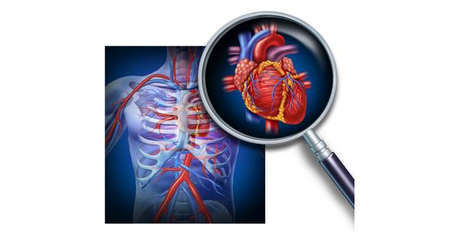 CHD-D&C-THS