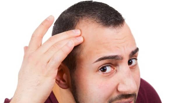 beauty-male grooming-balding myths in men-expert advice-THS