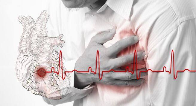 Heart problems