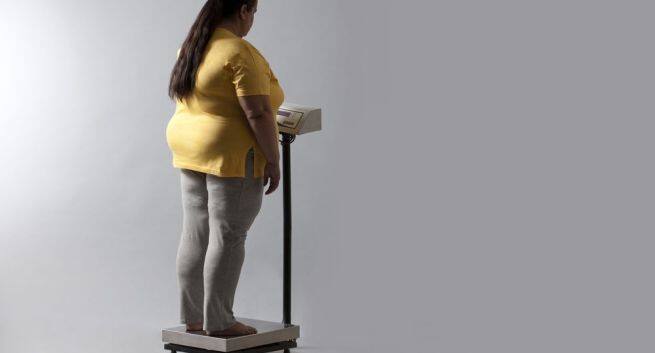 Obesity