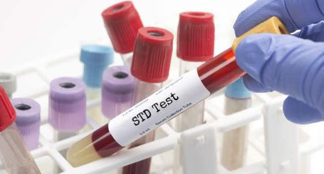 Tests For Sexually Transmitted Diseases And How To Read The Medical Report