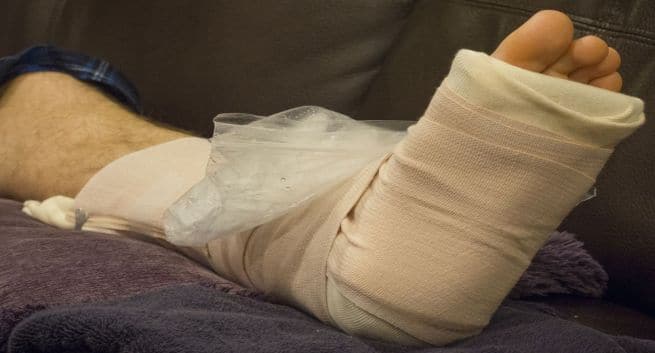 Fracture Care 5 Dos And Don’ts When You Have A Cast Or