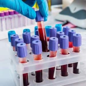 Here's why you need to do a glucose challenge test during pregnancy Here's why you need to do a glucose challenge test during pregnancy