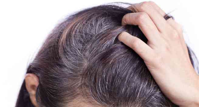 grey hair