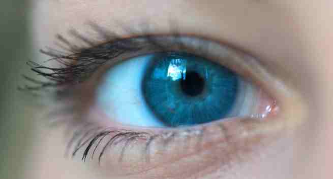 Bluish sclera