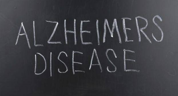 alzheimers
