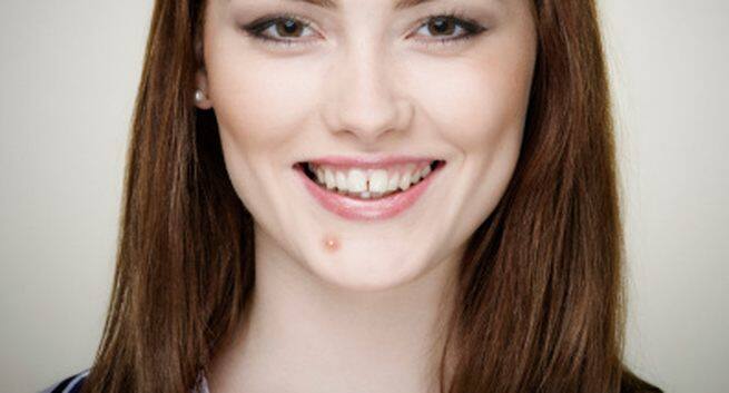 Acne Hindi