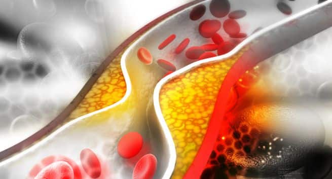 Helps-in-reducing-bad-cholesterol-levels Hindi