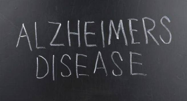 alzheimers