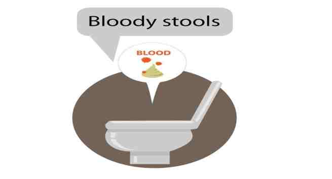 bloody-stools