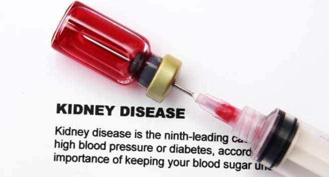 kidney-disease