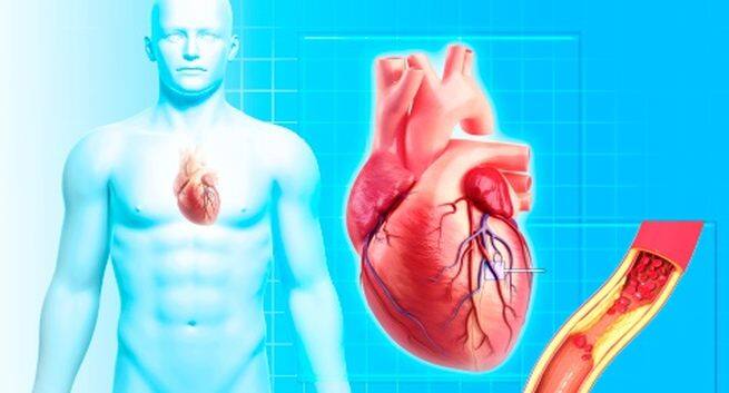 Cardiovascular disease