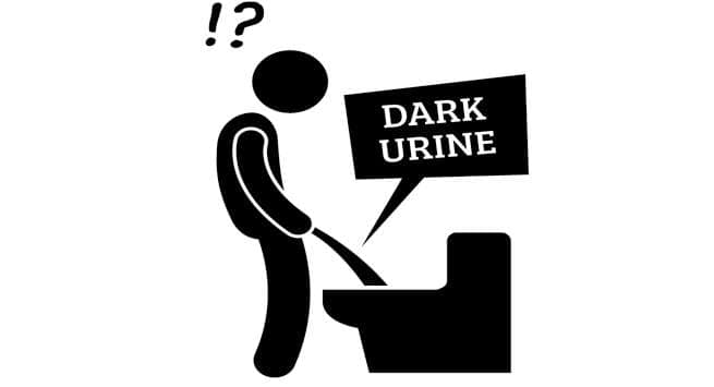 dark urine