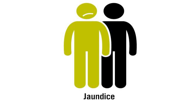 jaundice