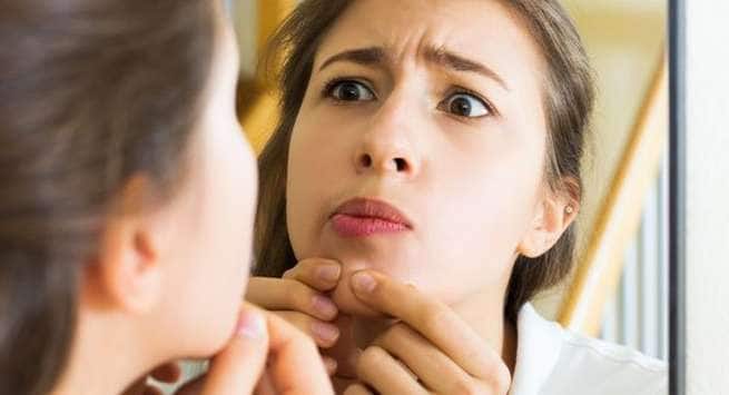 Popping-a-pimple