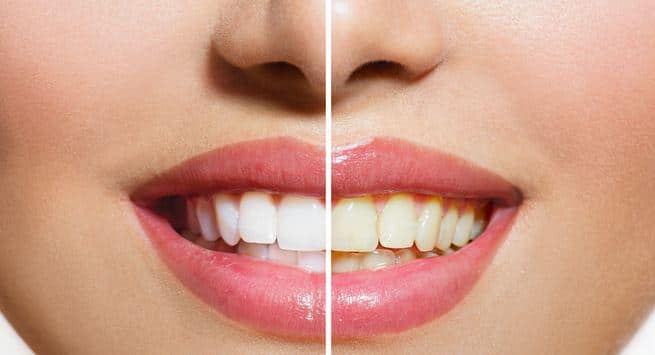 Foods that stain y our teeth and make you look older