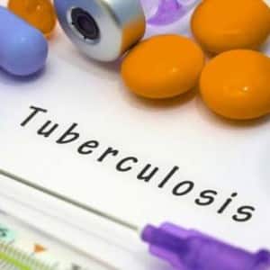 Corporates join Himachal Pradesh government in efforts to end TB in the state by 2021 Corporates join Himachal Pradesh government in efforts to end TB in the state by 2021