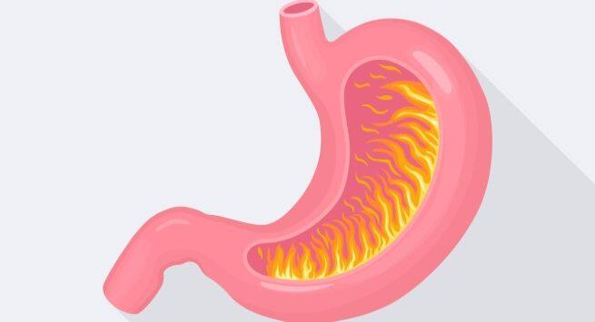 stomach-acid-in marathi