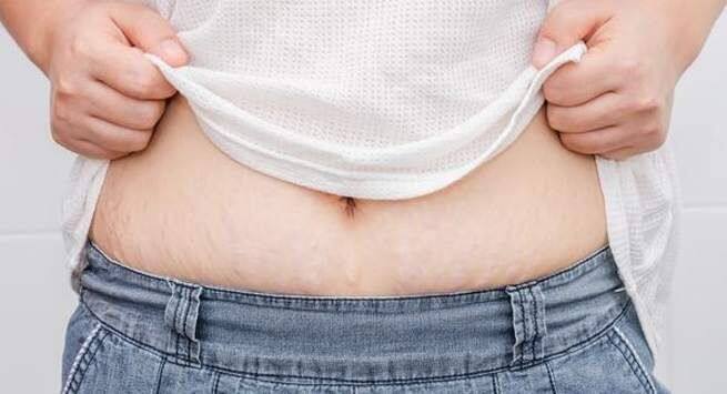 Stretch-marks-in marathi