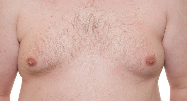 man boobs