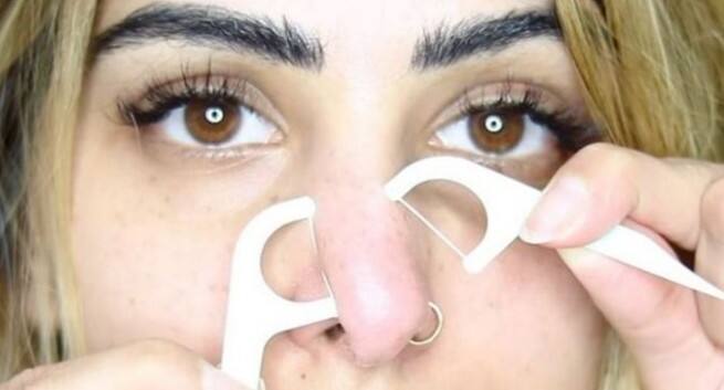 dental floss around skin tag