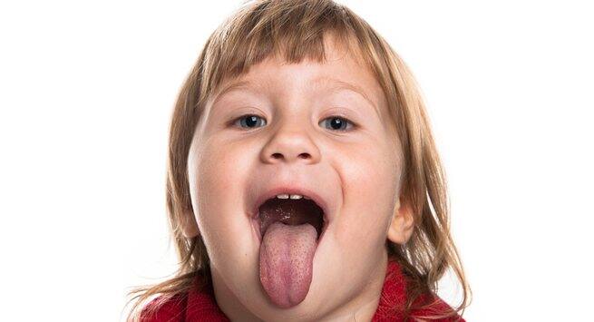 Black hairy tongue