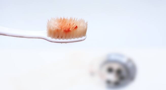 Bleeding gums