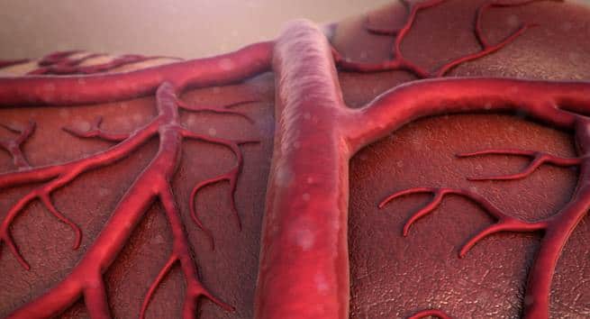 Enlarged blood vessels