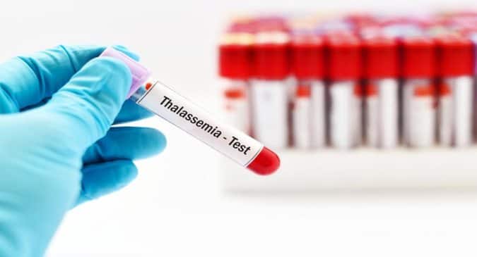 Thalassemia: Actor Jackie Shroff urges couples to get tested Thalassemia: Actor Jackie Shroff urges couples to get tested