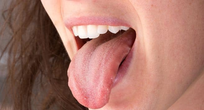 Oral Health Tongue 90