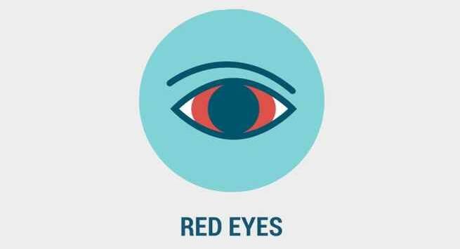 red-eyes-symptoms of zika virus