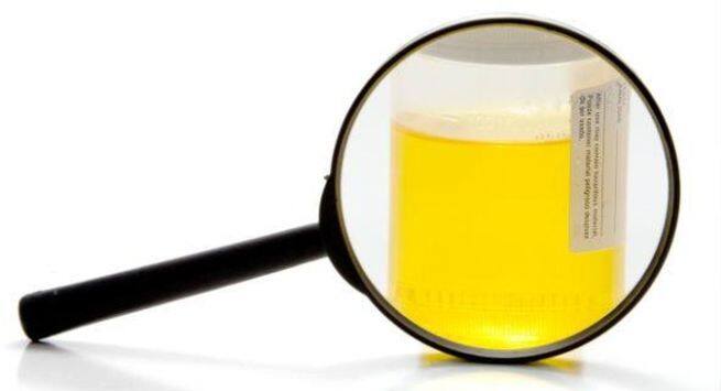 urine-colour