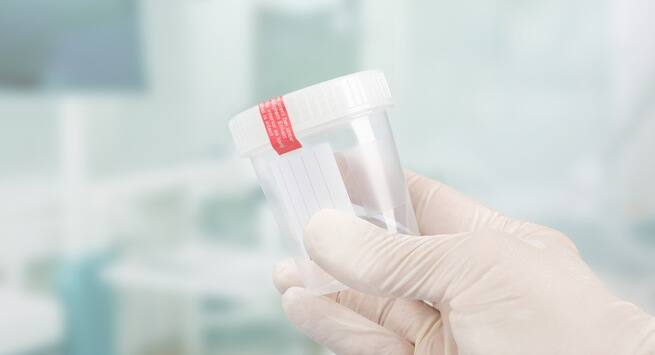 Low-semen-volume-sign low sperm count