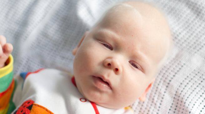 albino-baby Hindi