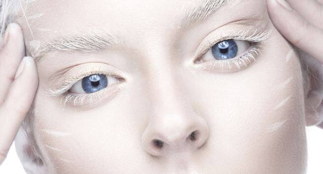 beautiful-albino-eyes Hindi