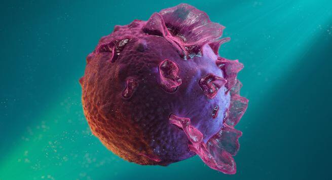 mononucleosis