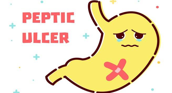 Peptic ulcer
