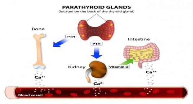 parathyroidism symptoms checklist