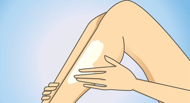 Use over the counter cream or lotion
