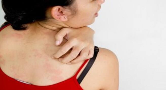 Body Colour symptoms in hindi